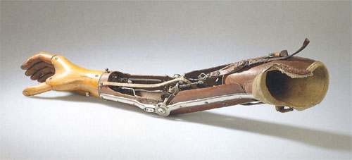 Aktive Oberarmprothese, um 1930